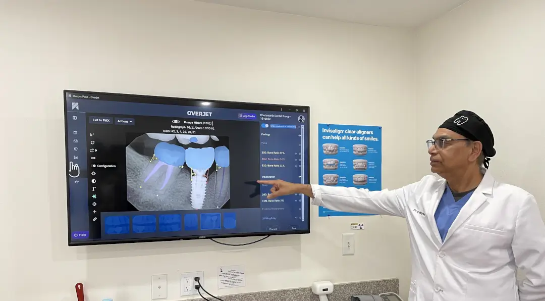 Using radiographic overjet ai tool